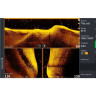 LOWRANCE Active Imaging HD 3-in-1 FishReveal High/Wide — датчик 000-16061-001